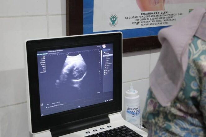
 Dinkes Fasilisi USG Gratis Diseluruh Puskesmas. Foto: ist